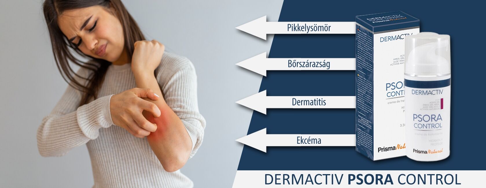 Pikkelysömör (psoriasis) tünetei, kezelése - Dermatica